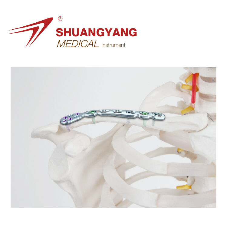 Distal Clavicle reconstruction locking plate