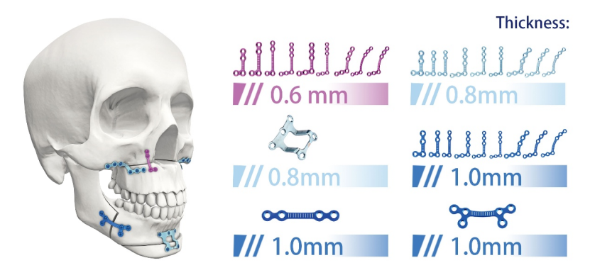 06mm thickness orthognathic series anatomical l plate titanium maxillofacial plate6 holes-1