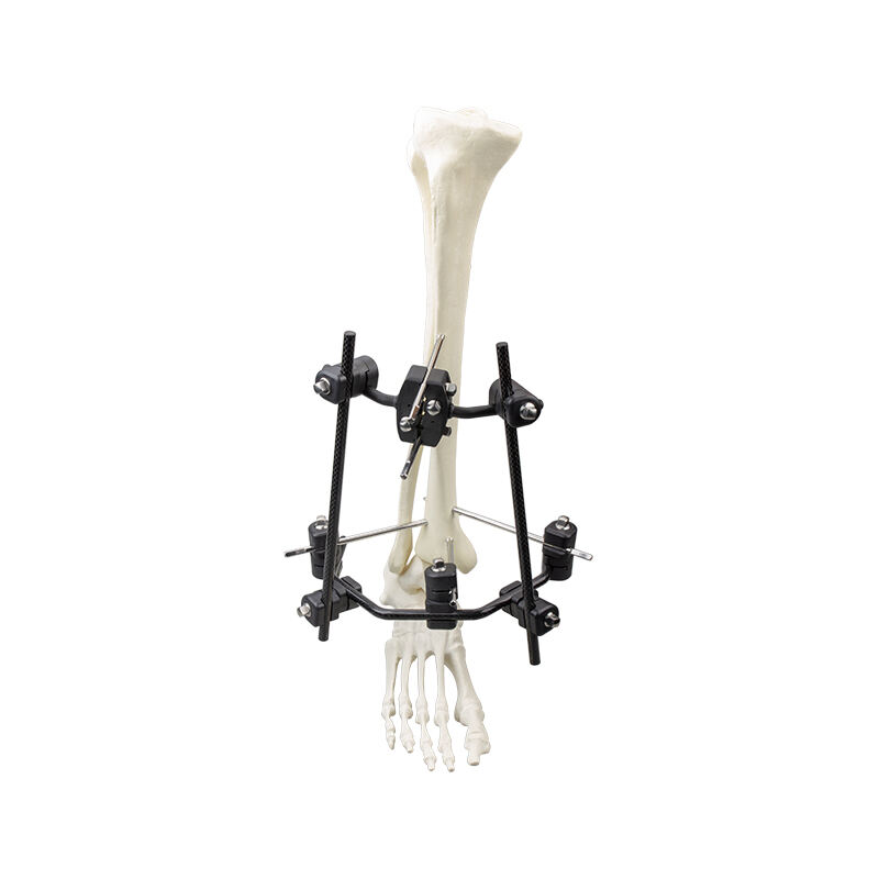 Φ8.0 Series External Fixation Fixator – Distal Tibia Semicircular Frame