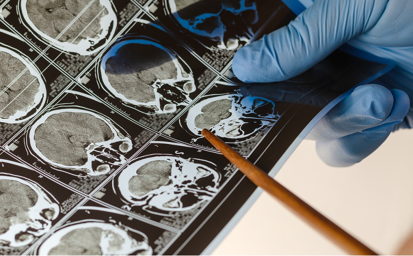 2d round hole flat titanium mesh used for skull restoration system-9