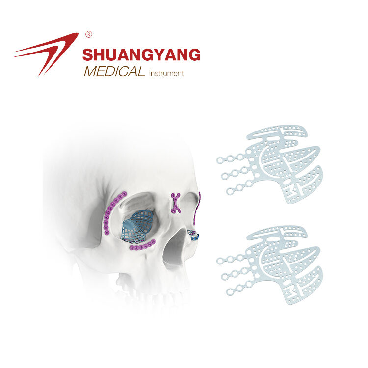 Customization Pre-shaped Orbital Floor Plate Type-V