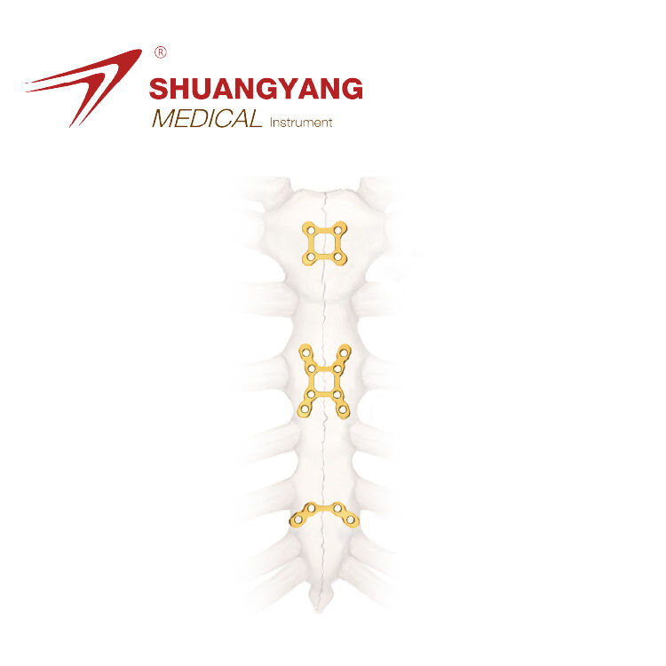 2.4 Series Sternal Reconstruction Locking Plate