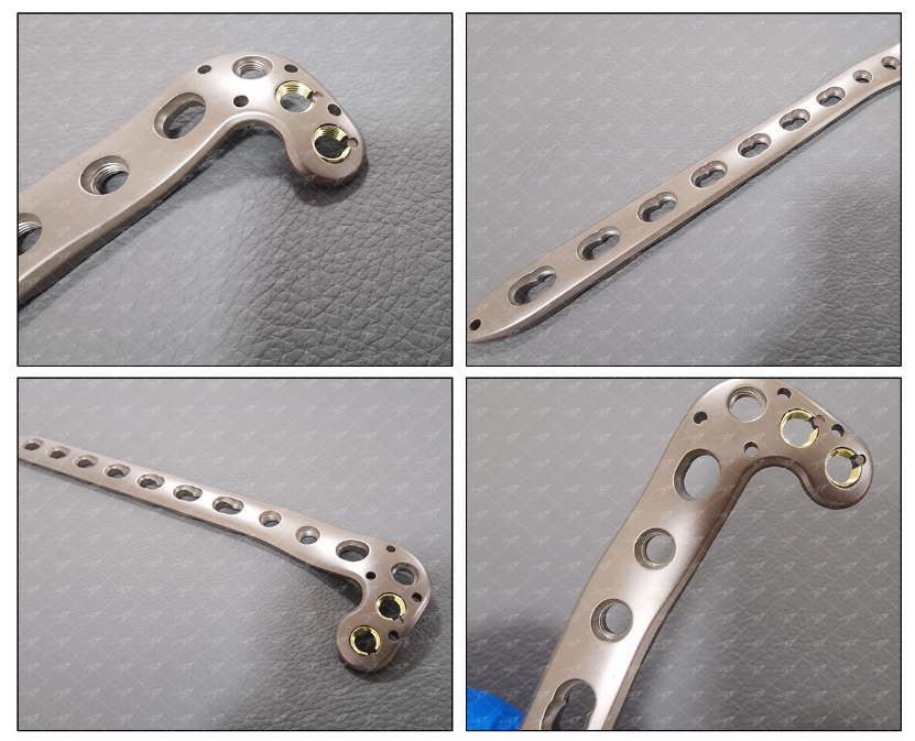 medial tibia plateau locking plate574-4