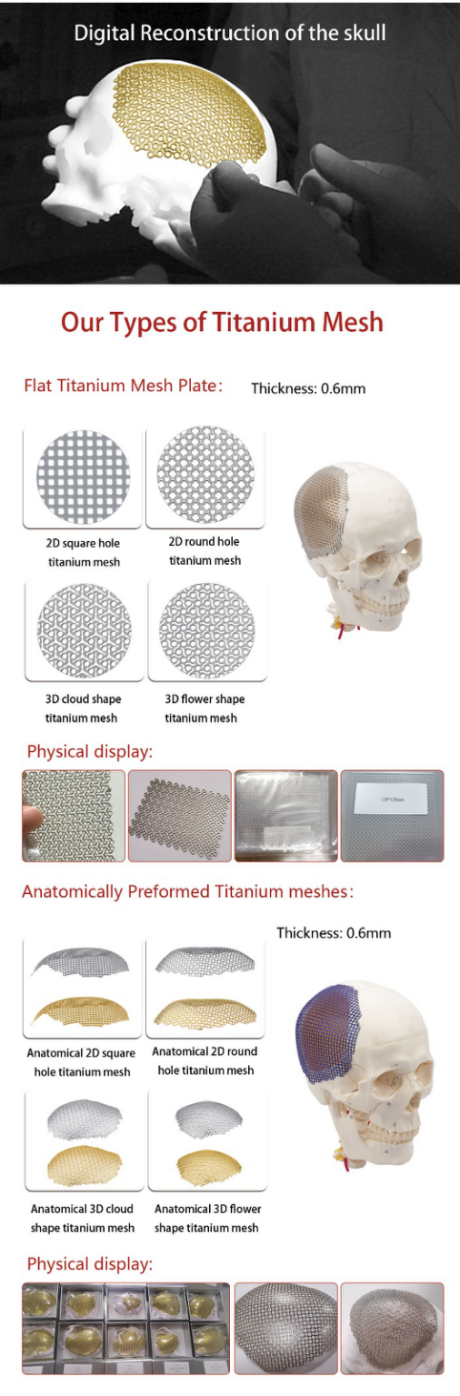 anatomical 3d flower shape titanium mesh used for skull restoration system-2
