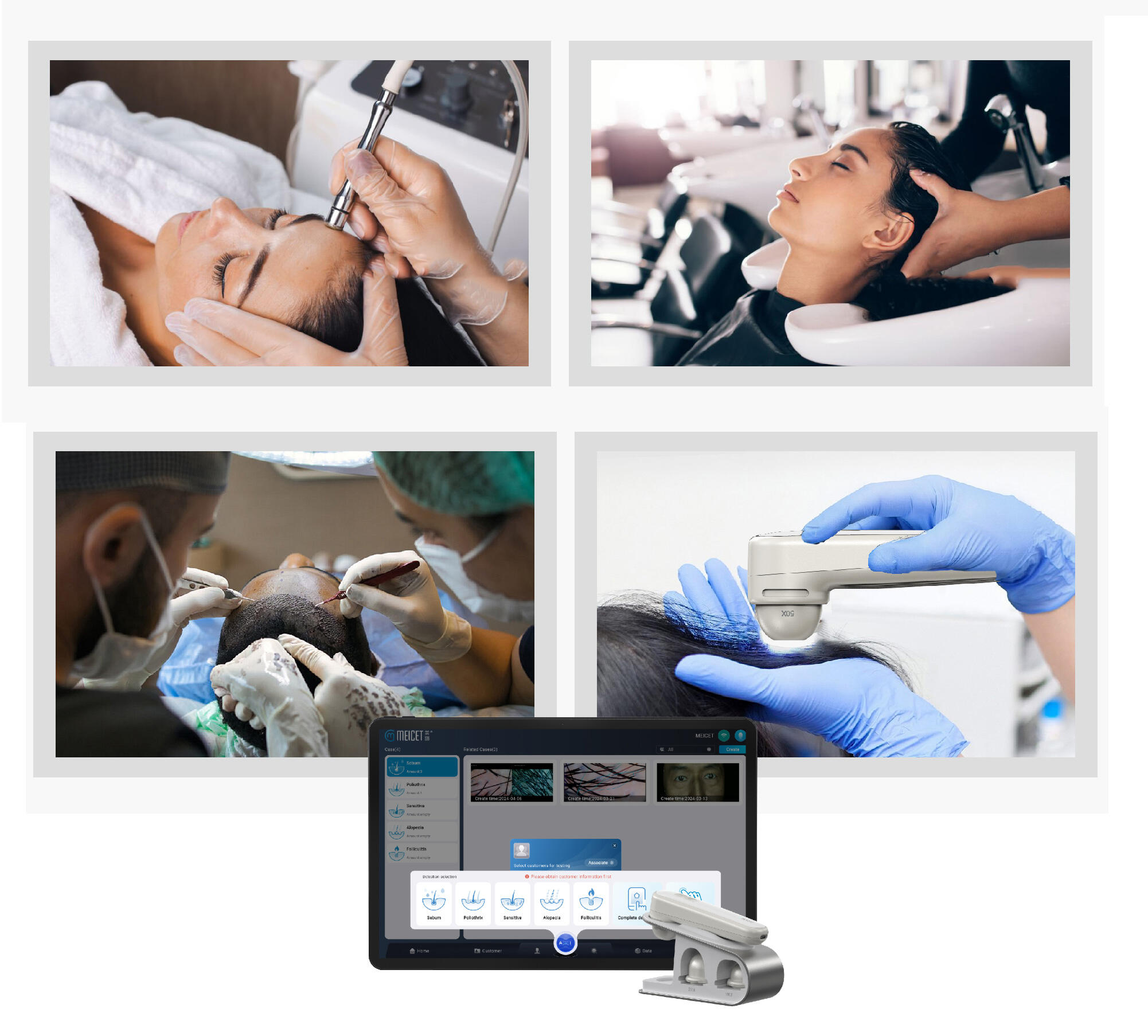 Scalp Analysis and Provides Data Security