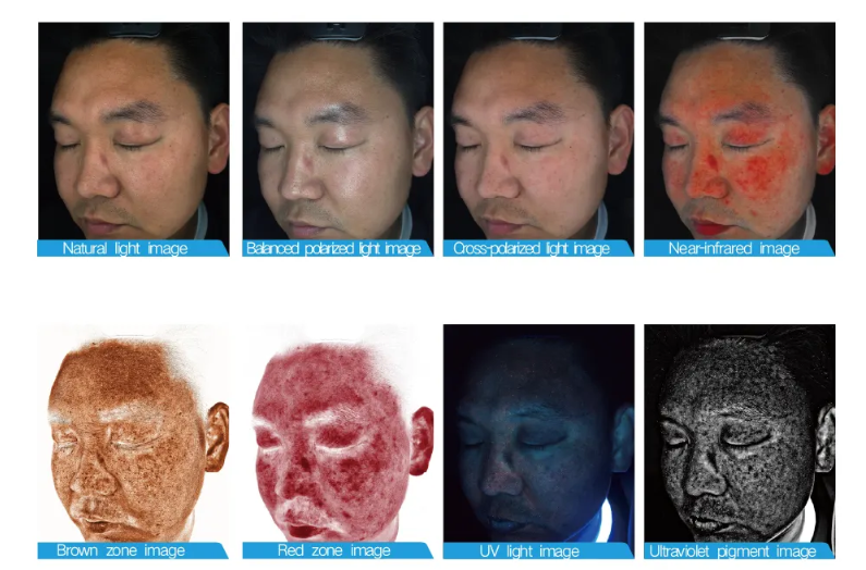 Digital Skin Analysis: The Future of Personalized Skincare