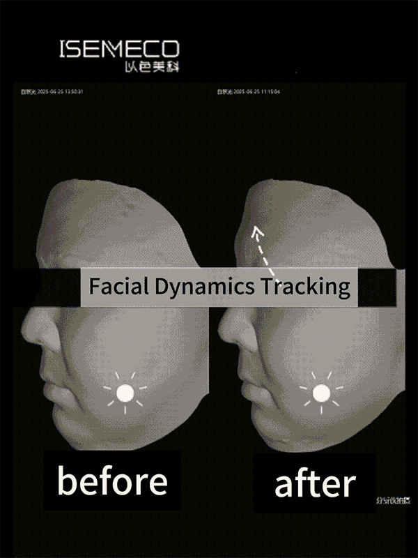 skin-analyzer--before-after.gif