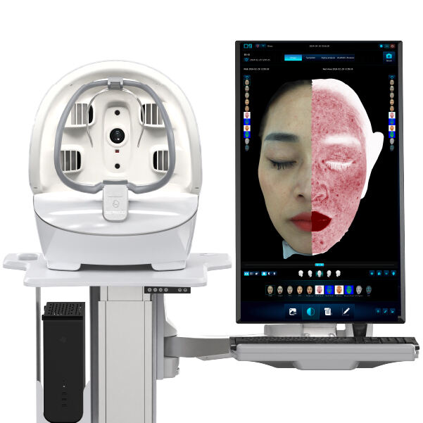 Why Using a Skin Analyzer Can Help You with Your Beauty Routine?