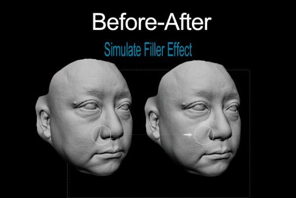 Before-After.png