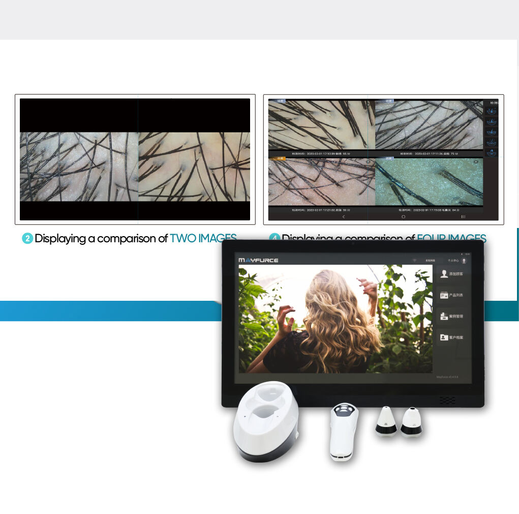 Connectens cum scalpendi cura Ecosystem