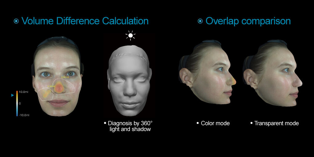 Volume-Difference-Calculation.jpg