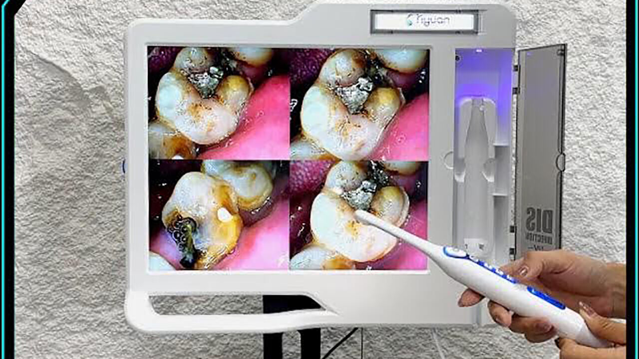 Máy quay intraoral nha khoa chất lượng cao màn hình HD LED với thiết kế thùng bụi UV tích hợp