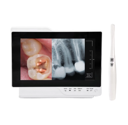 How Intraoral Cameras Help Improve Communication Between Dentists and Patients