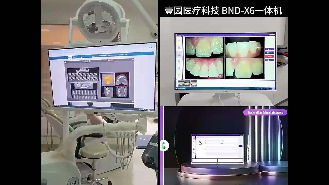 Máy nội soi camera miệng bán chạy có màn hình cảm ứng kèm phần mềm chuyên dụng tích hợp