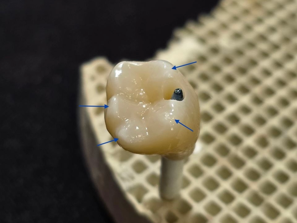 The Hidden Risks of Incorrect Sintering Temperatures