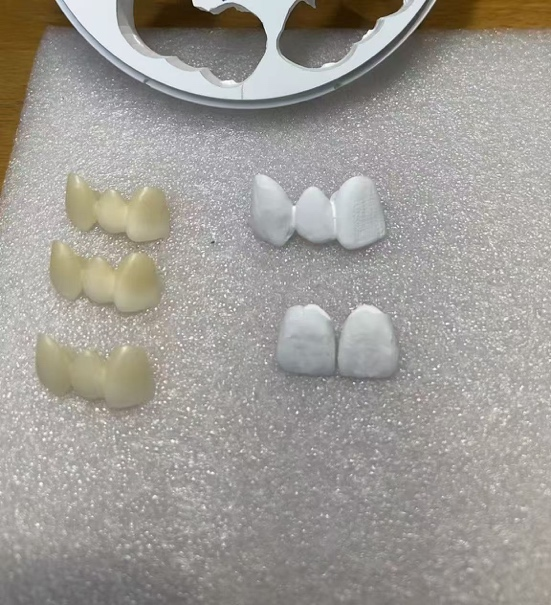 Why Does Your Zirconia Turn Gray After Sintering?