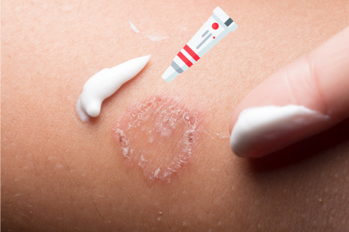 GMP production environment and microbial limit control requirements for topical antifungal creams.