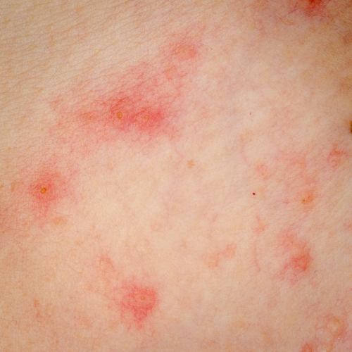 hydrocortisone cream manufacturer.png