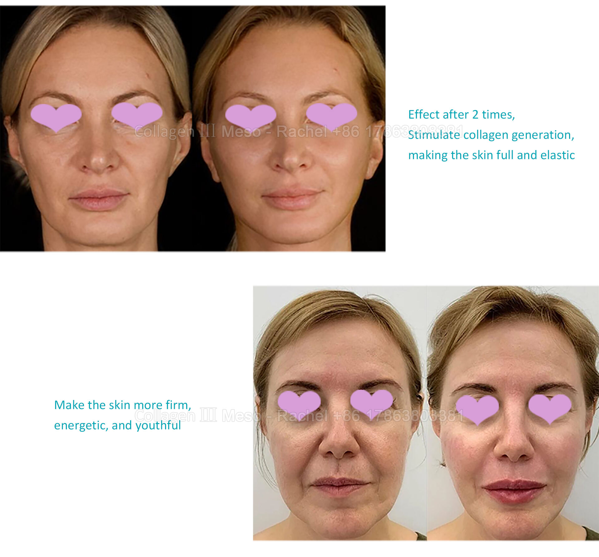 collagen-psd_04.jpg