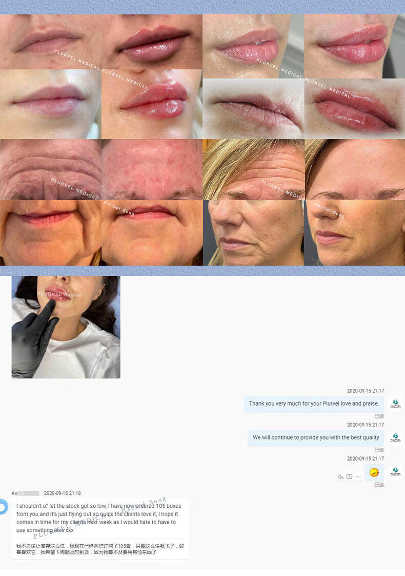 Plurvel 1ml Derm旧版 详情页 (8).jpg