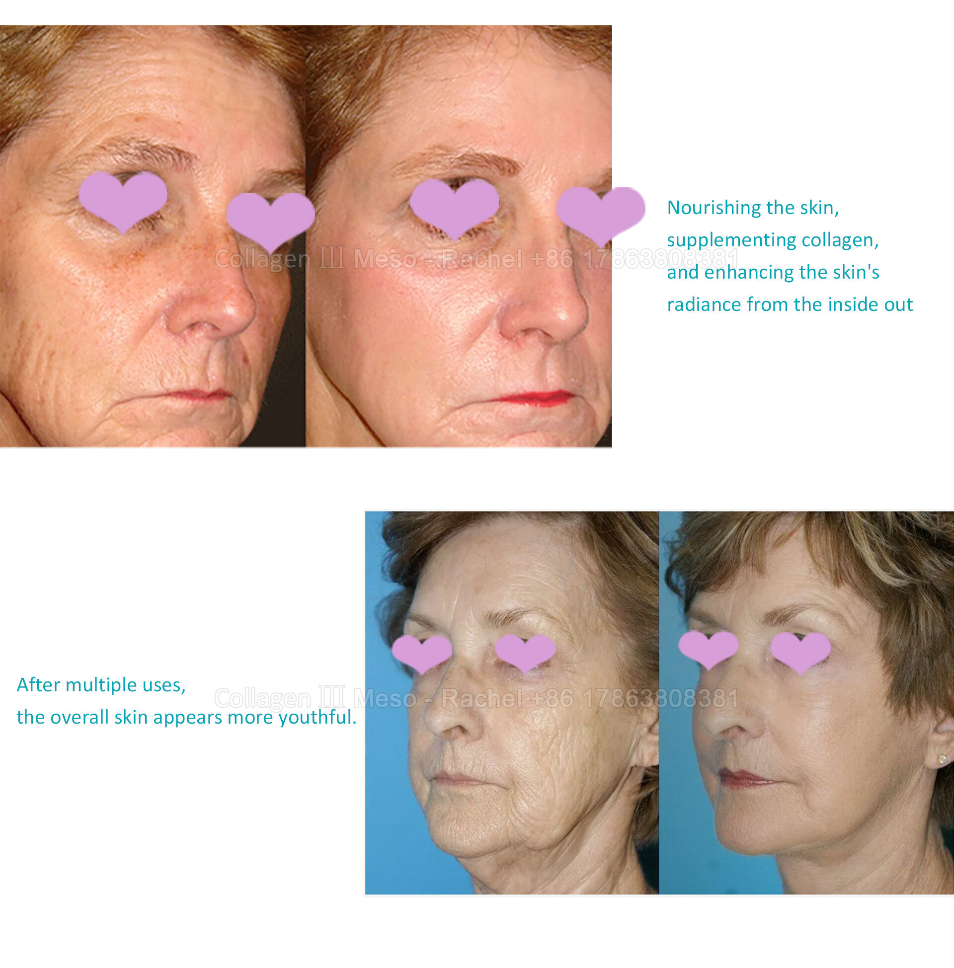 collagen-psd_05.jpg
