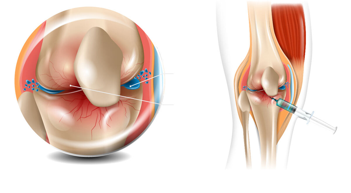 히야론동국앵미® - High-Quality Hyaluronic Acid Solutions for Medical Aesthetics | Shandong Plurvel Medical Technology Co.,Ltd