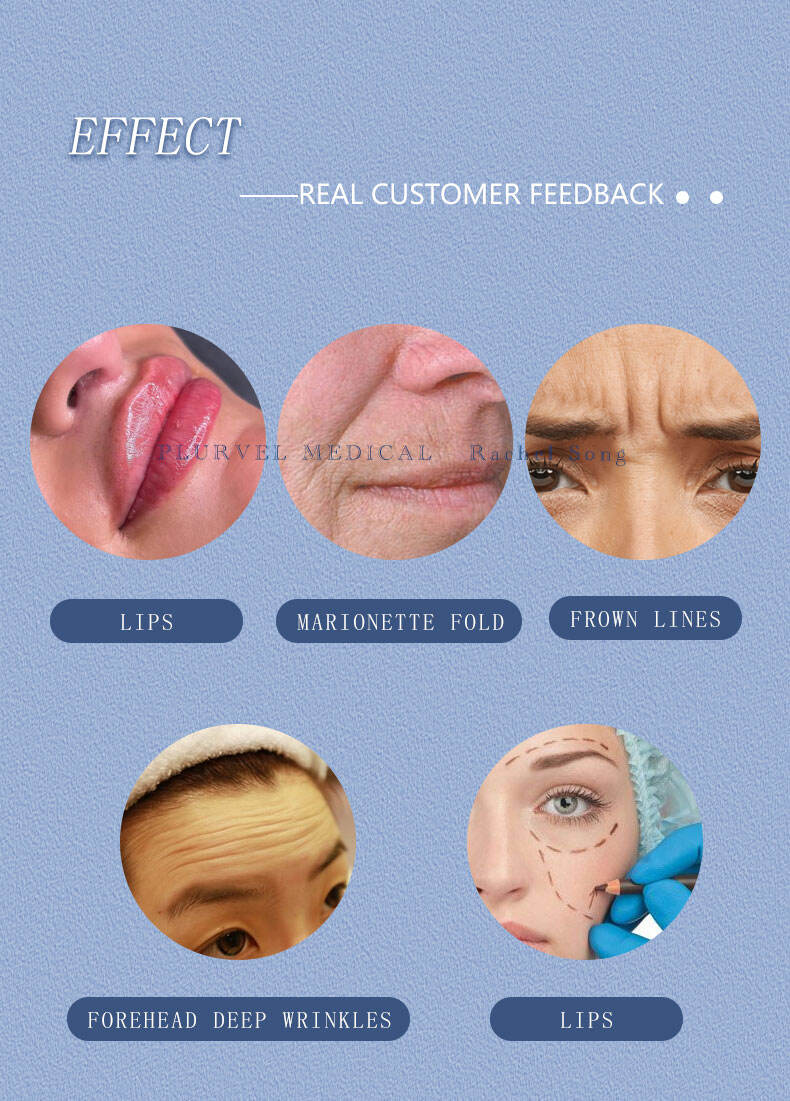 Plurvel 1ml Derm旧版 详情页 (7).jpg