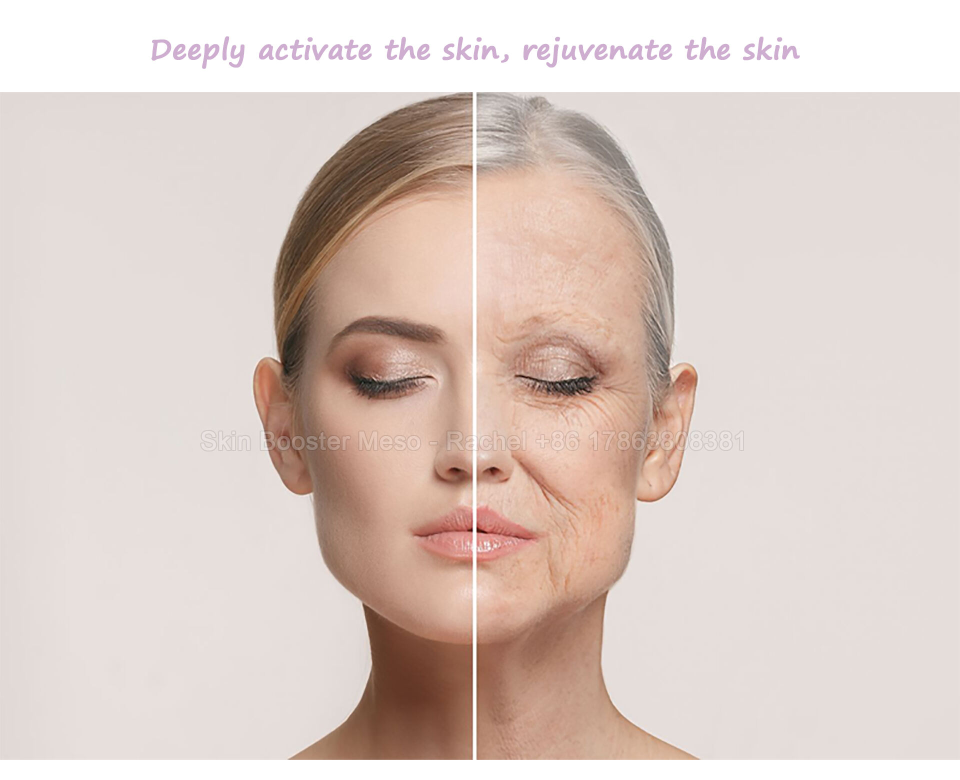 skin-booster---PSD_01.jpg