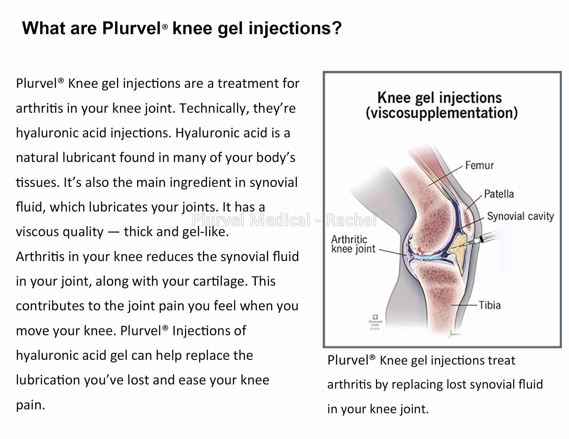 Rachel - Plurvel Knee  (2).jpg