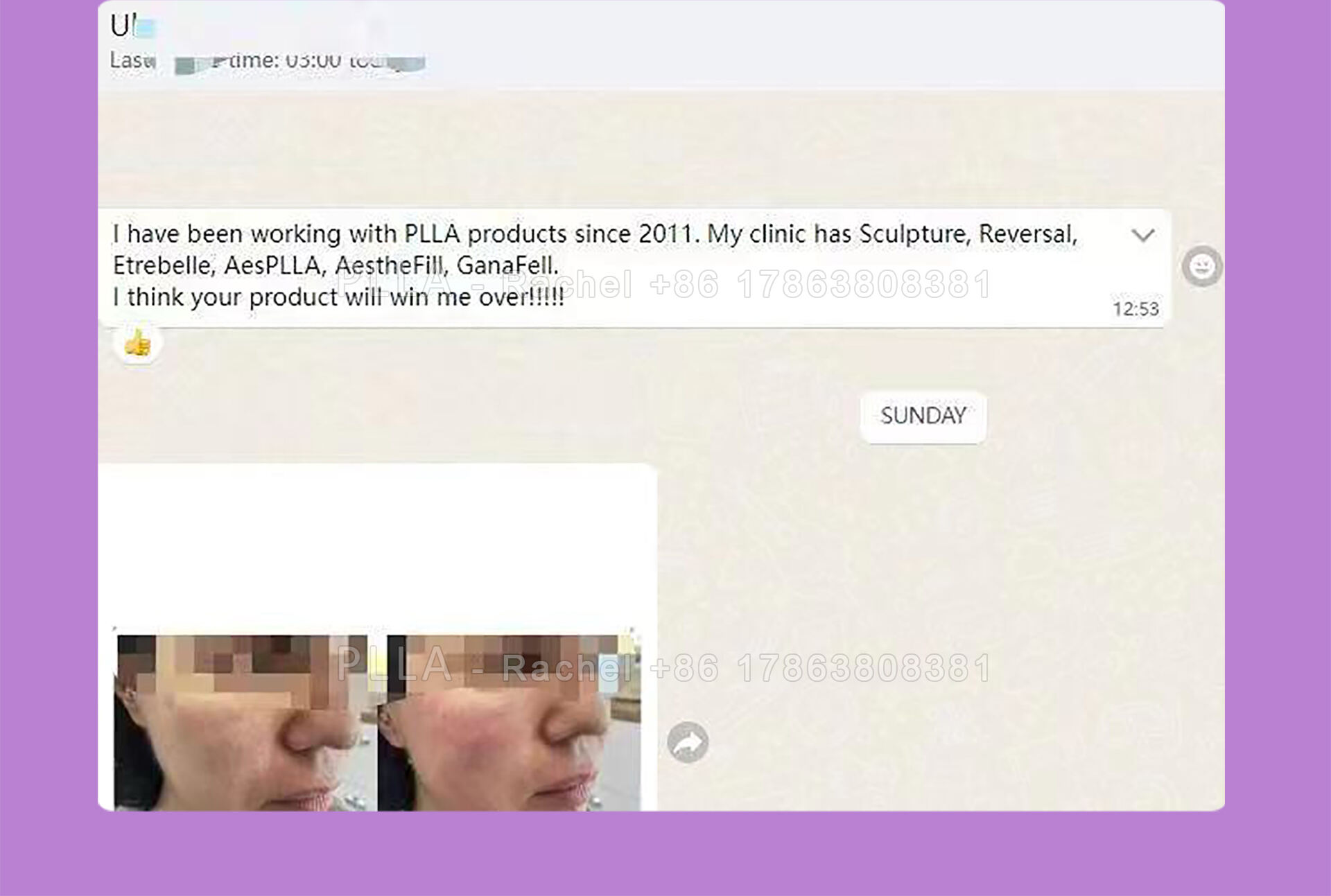 PLLA_09.jpg