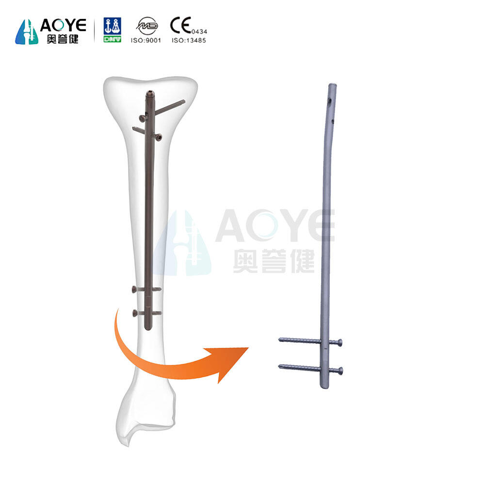 Tibial İntramedüller Çivi