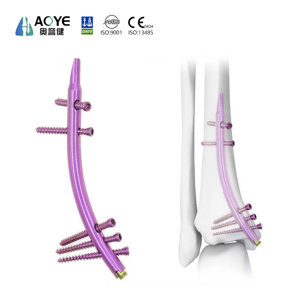 Distal Tibial İntramedüller Çivi (DTN)