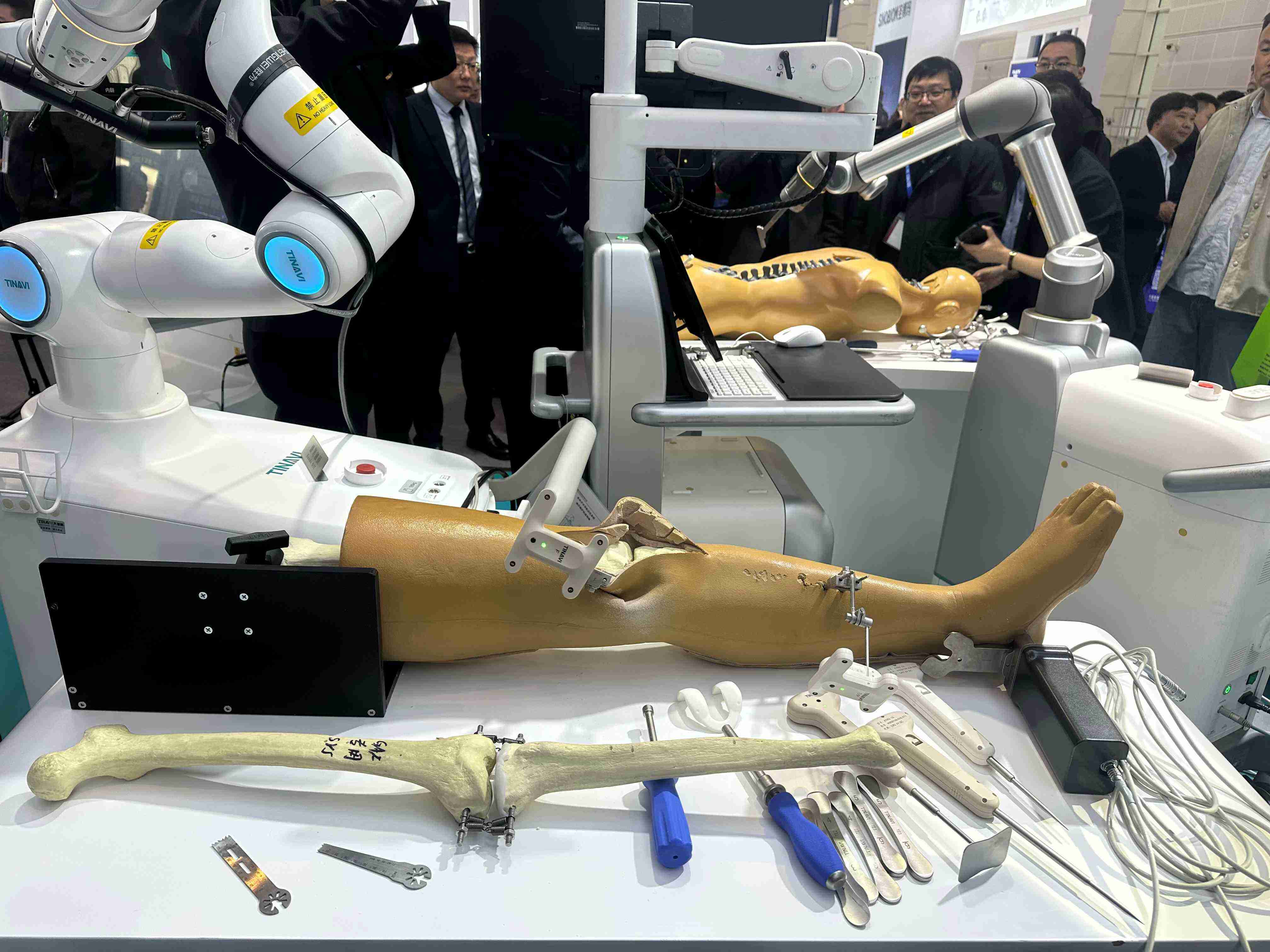 Taruk Leadership Explores Orthopaedic Innovation and Customer Collaboration at COA 2025 in Tianjin-6