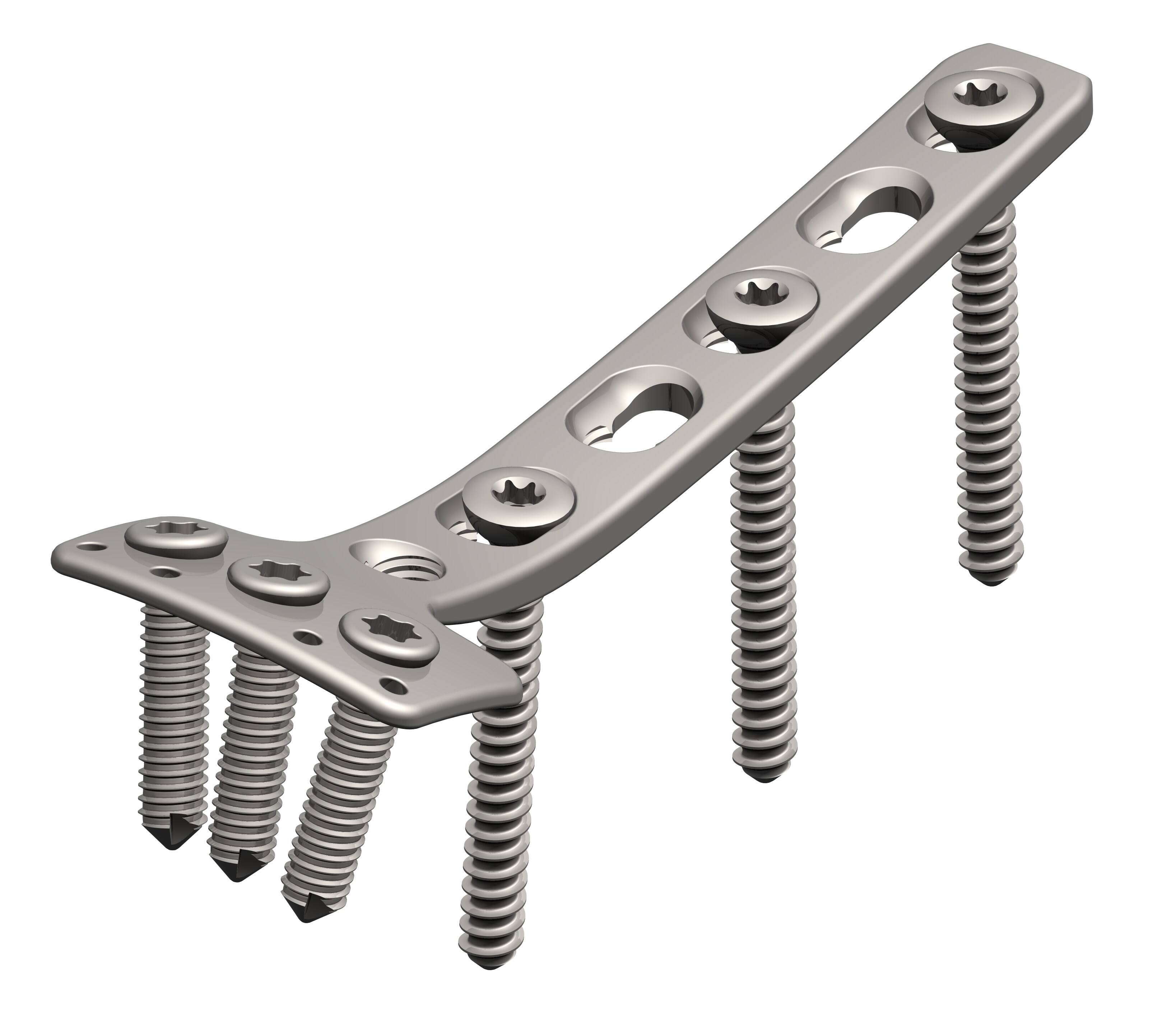 Locking Plates & Screws