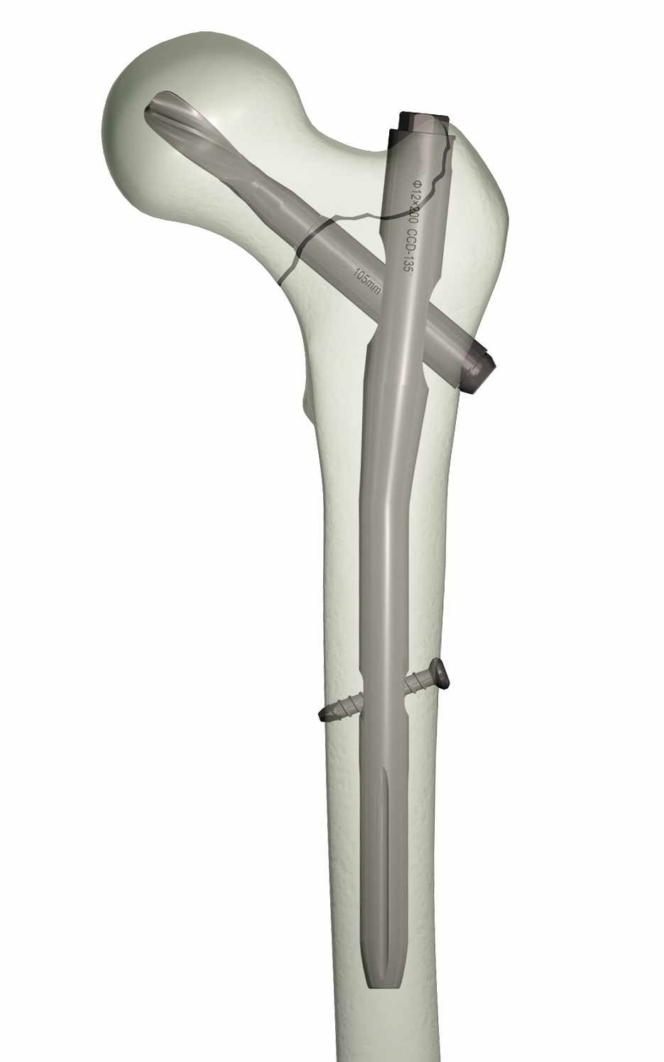 Tecnólogach Meicniúchán Lochaíochta Fosta