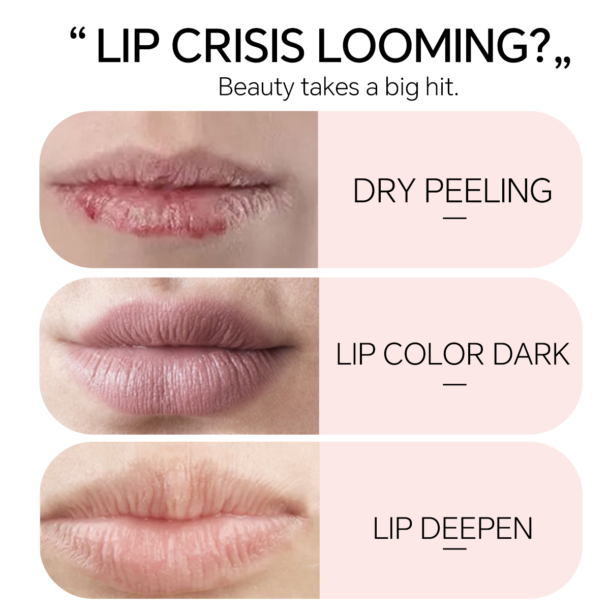 Carotene Temperature Chenange Lip Balm