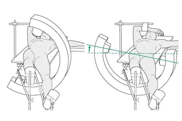 Femoral Intramedullary Nailing: Key Surgical Principles  