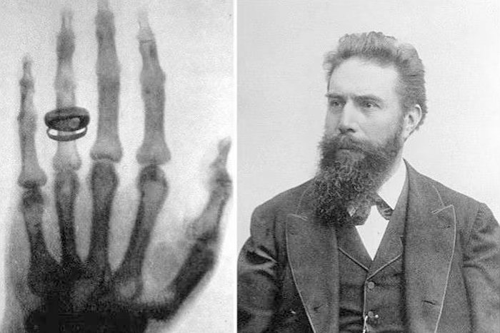 Portable X-ray machine - The precise 