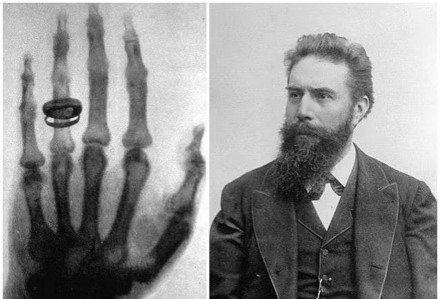 Portable X-ray machine - The precise "viewing eye" in surgery