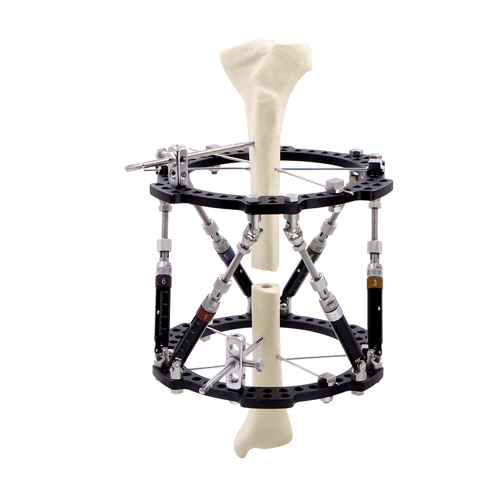 External Fixation System