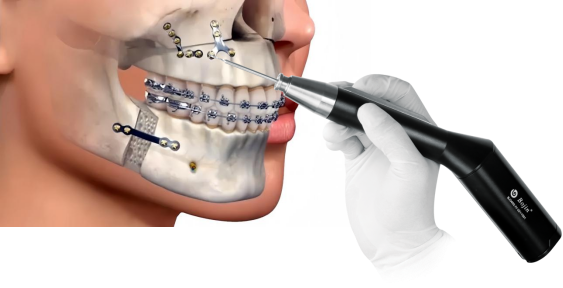 The Era of Precision Medicine in Minimally Invasive Maxillofacial Surgery
