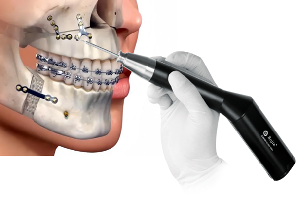 The Era of Precision Medicine in Minimally Invasive Maxillofacial Surgery