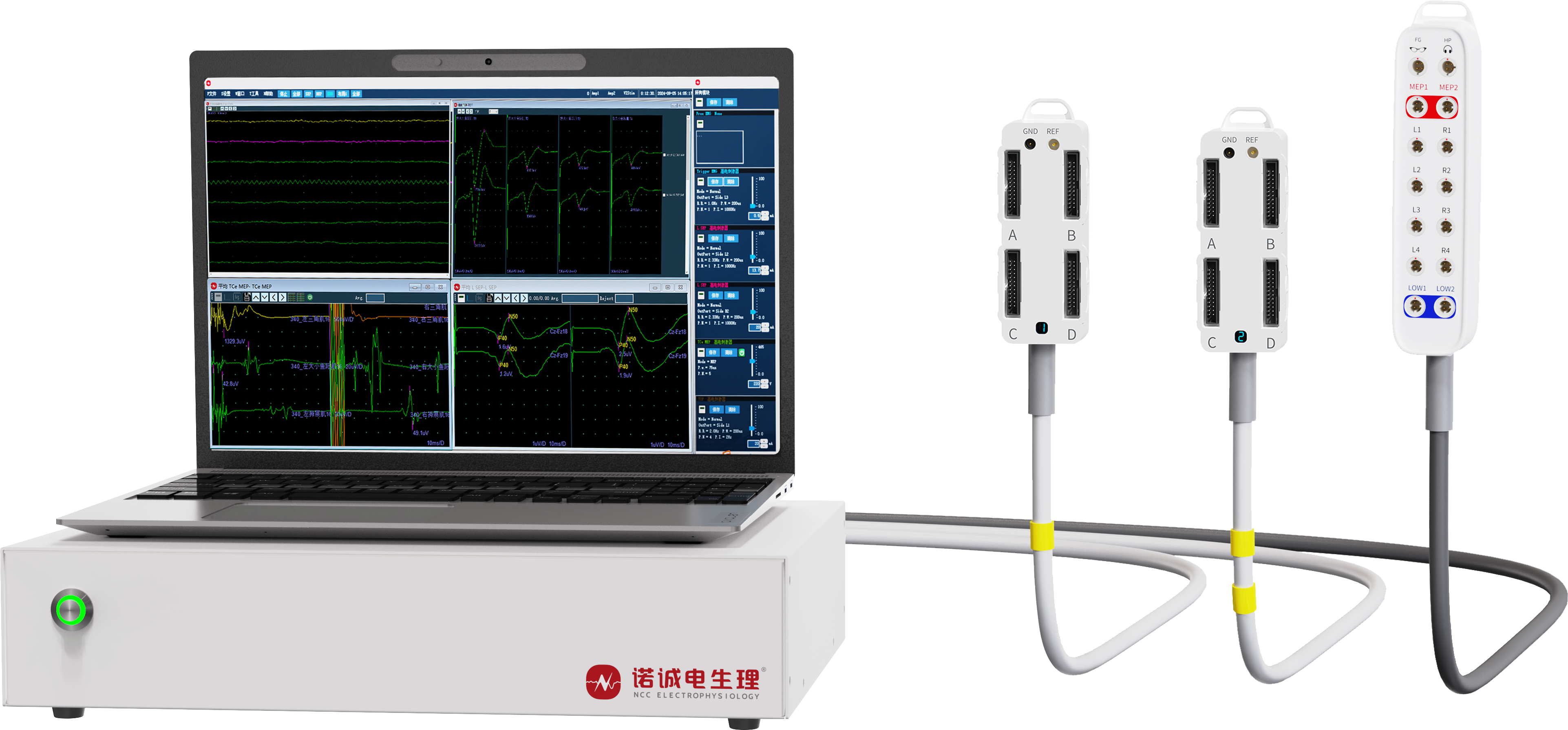 Optimizing Clinical Workflow: The Role of Ionm Neuromonitoring in Modern Neurophysiology Departments