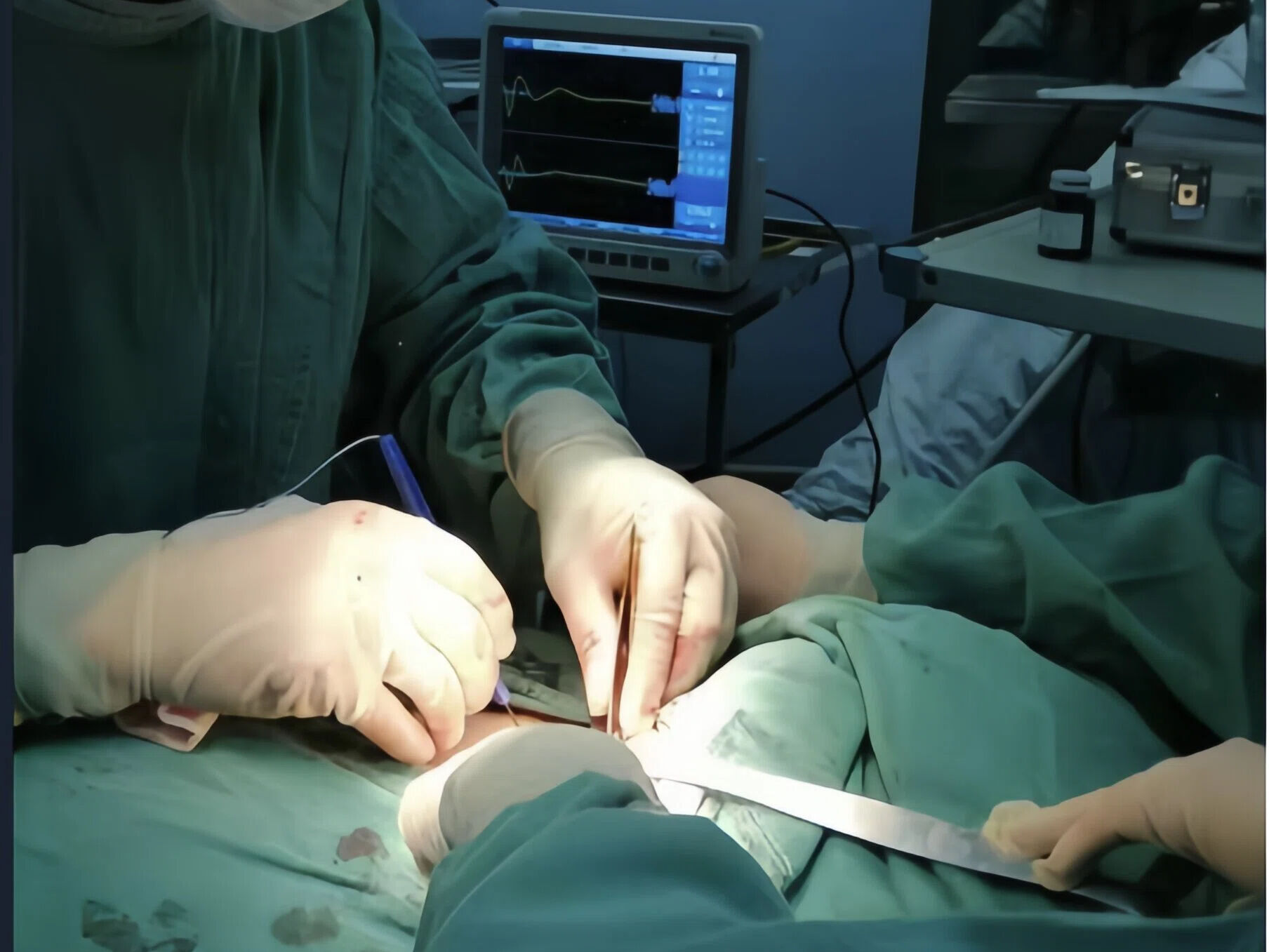 گزارش نظارت عصبی در حین عمل جراحی تیروئید