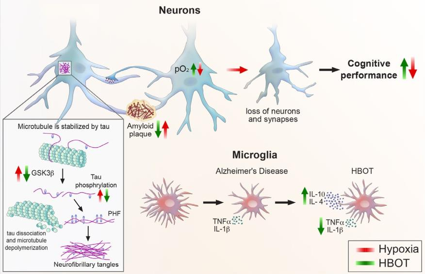 Health Insights | A New Breakthrough in Alzheimer’s Care — Hyperbaric Oxygen Therapy