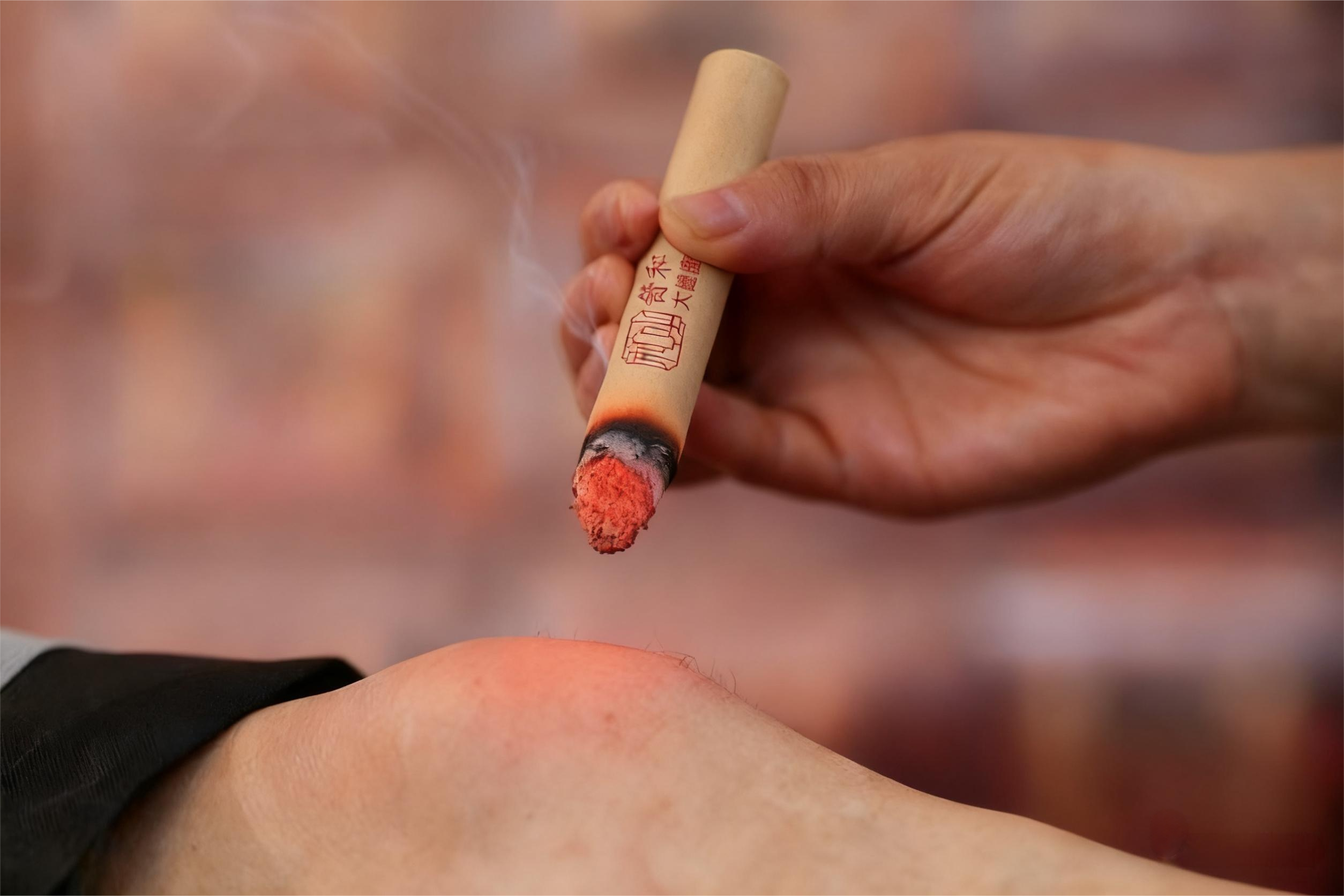Why is moxibustion moxa essential?