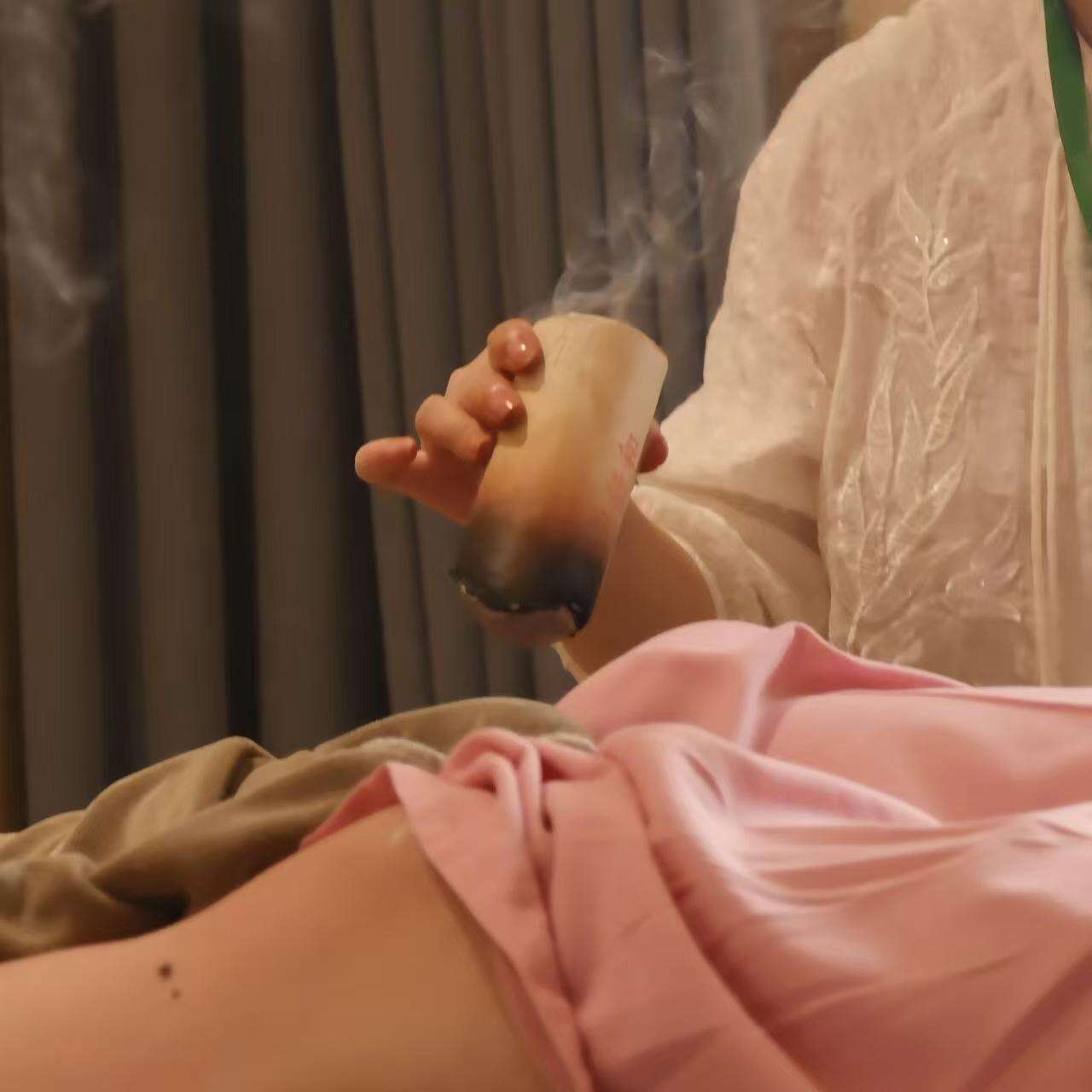 Moxibustion Brings Ancient Chinese Warmth Back Into Modern Wellness.jpg