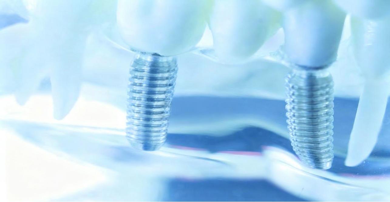 8titanium alloy the bio friendly core material in the medical field-1