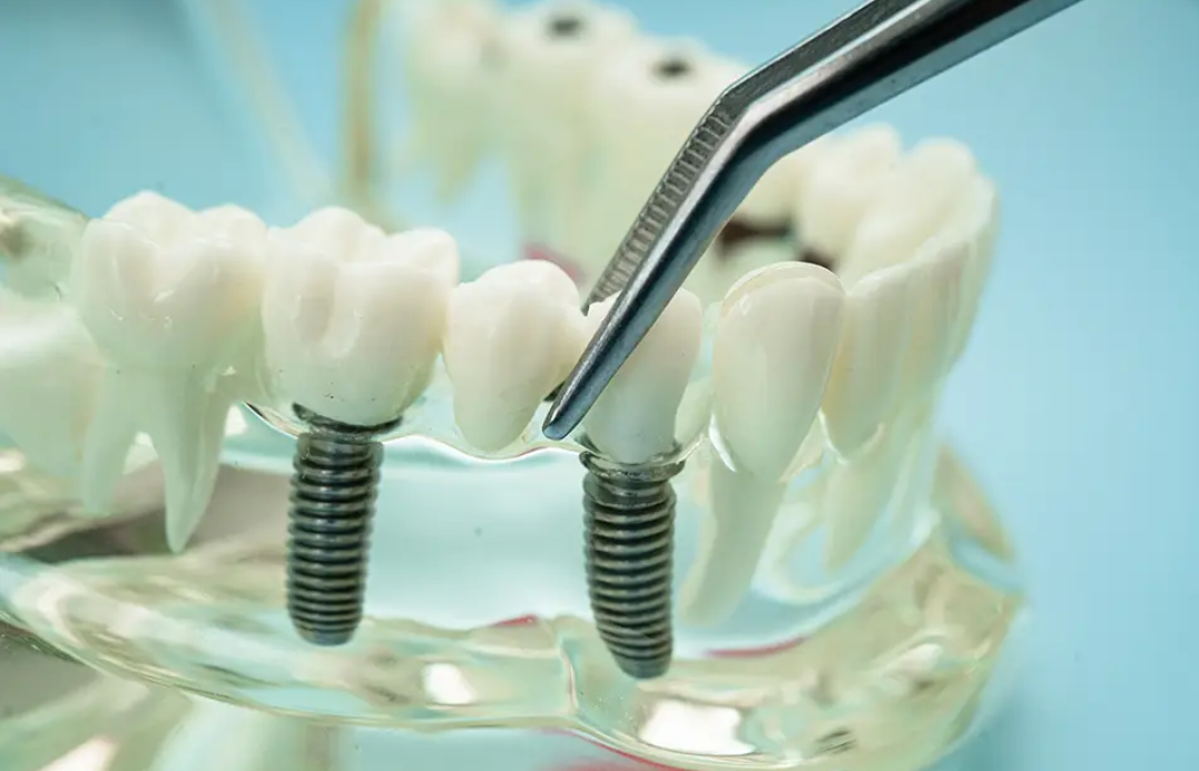 Ein umfassender Leitfaden zur Verwendung von Ti-6Al-4V-Pulver für hochfeste 3D-Druckverfahren.