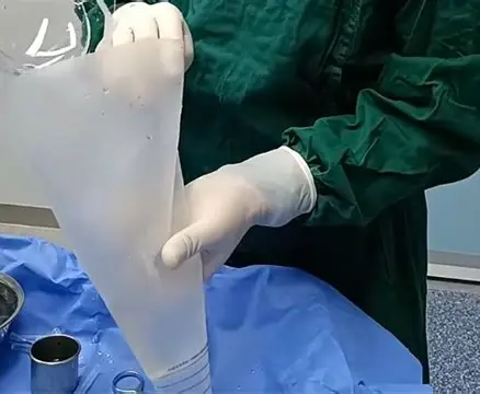 Prosthetic Conveyor Belt - The Minimally Invasive and Safe Experience of Reconstructive Plastic Surgery
